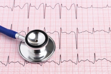 L’elettrocardiogramma: storia e significato